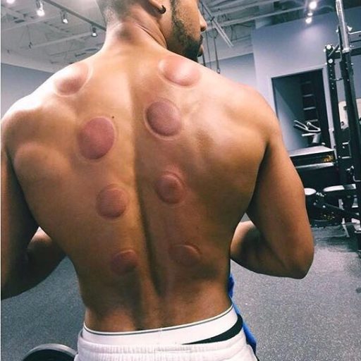 رفع أداءك الرياضي مع علاج الحجامة في أبو ظبي رؤى الخبير مدحت حجازي