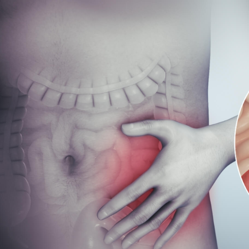 Hijama for Digestive Health in Abu Dhabi