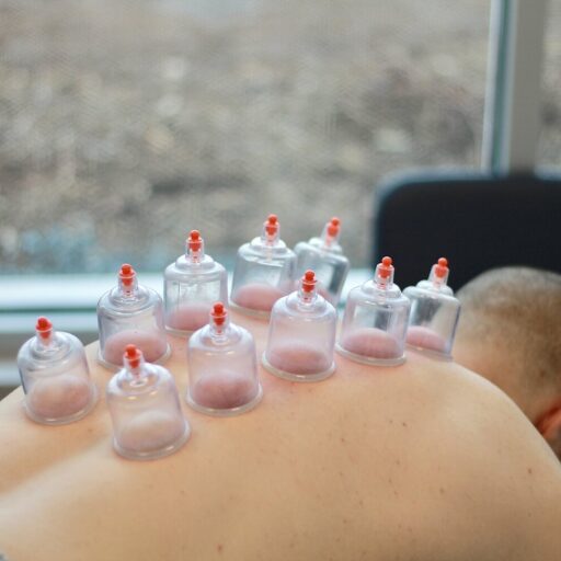 Hijama for Posture Correction in Abu Dhabi